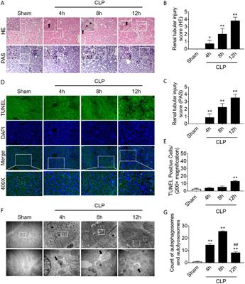 p53 Deacetylation Alleviates Sepsis-Induced Acute Kidney Injury by Promoting Autophagy